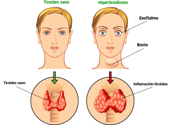 Representación anatómica de la glándula tiroides